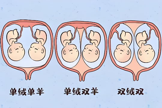 广州三代试管双胞胎费用多少？和单胎有区别吗？<