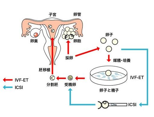 三代试管婴儿成功率高吗？流程中哪些因素影响结果